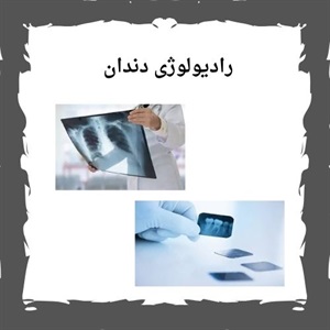 رادیولوژی دندان و اهمیت آن در تشخیص مشکلات دندانی