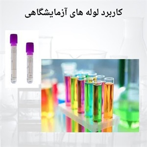 بررسی مشخصات مهم انواع لوله آزمایشگاهی