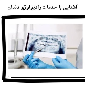 نقش رادیولوژی دندان در بهبود روند درمان