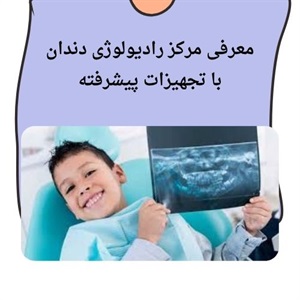 مزایای انتخاب مرکز رادیولوژی دندان سعادت آباد